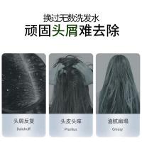 100年润发（CENTAINE）去屑止痒 氨基酸洗发露 200ML（单位：瓶）新老包装随机发货