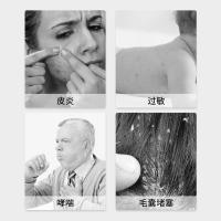 绿之源（GREEN SOURCE） 青花椒除螨喷雾 空气净化剂 300ml*2 钢琴白（单位：套）