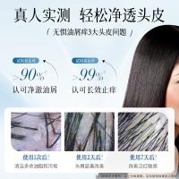 拉芳 控油去屑洗发水 二硫化硒 500g (单位:瓶)