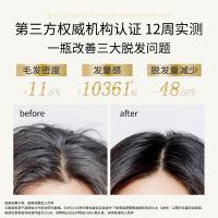 滋源（seeyoung） 生姜强根健发防脱洗头水  535ml（单位：瓶）新老包装随机发货